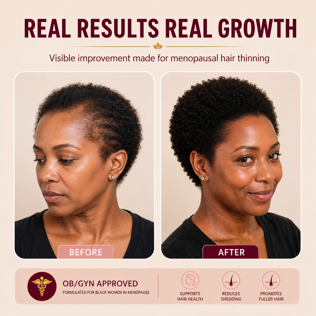 AURE Hair Helper Spray — For Menopausal Hair Loss in Black Women