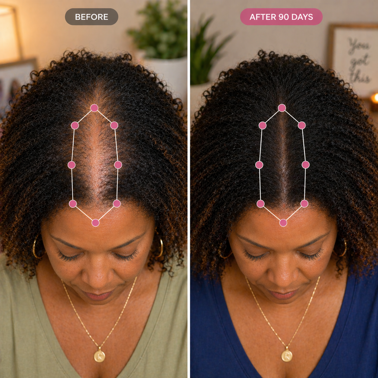 AURE Hair Helper Spray — For Menopausal Hair Loss in Black Women