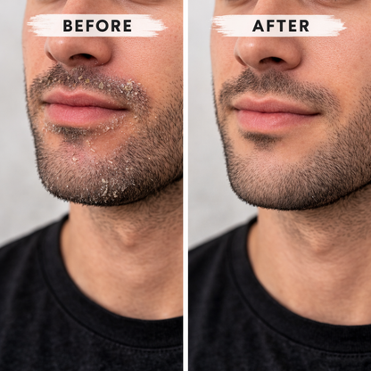 AURE Barrier Repair Balm